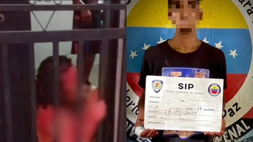 El caso que estremece a Guatire: Mujer fue brutalmente atacada a martillazos y puñaladas en su propia casa